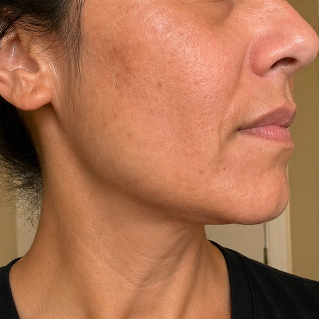 Customer 1 - Before