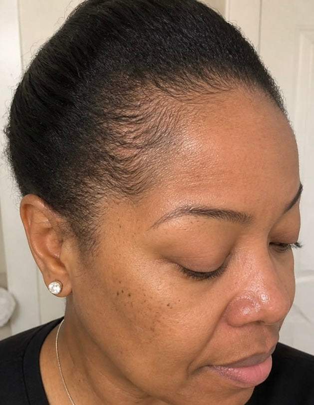 Customer 5 - After